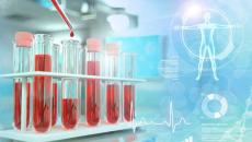 Blood test lab illustration